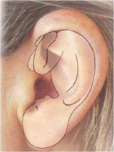 نقطه shen men در گوش