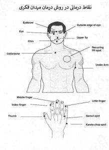 درمان میدان فکری یا Thought Field Therapy