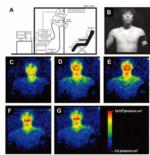 انتشار نور از بدن